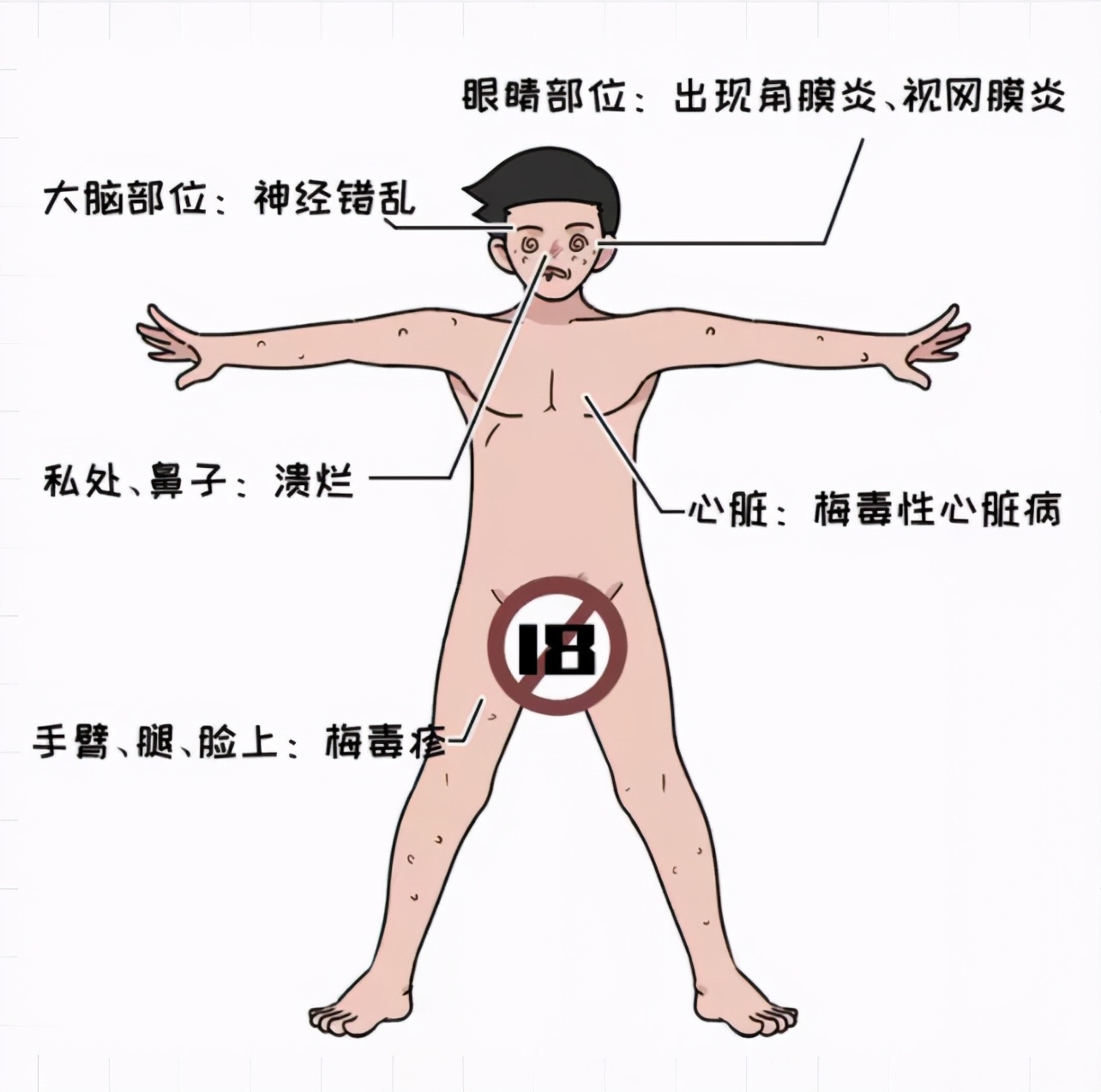 小伙被感染梅毒,晚期梅毒可能造成肺部损伤吗