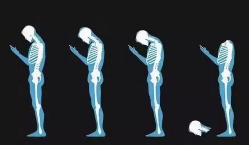 低头族按摩颈椎有什么好的仪器,低头族福音按摩仪