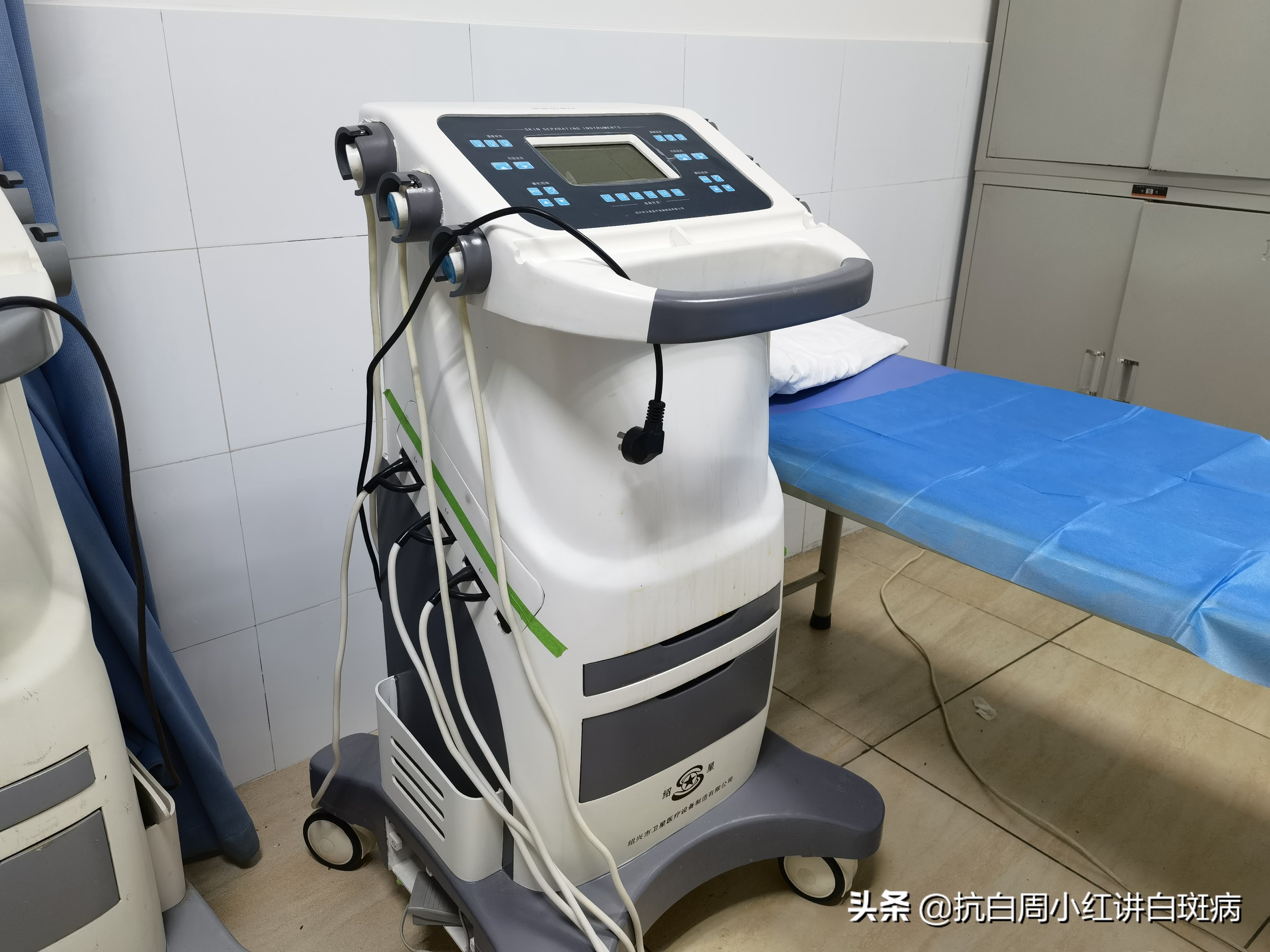 被猫抓伤会不会出现白癜风,撸猫被抓伤有保险吗