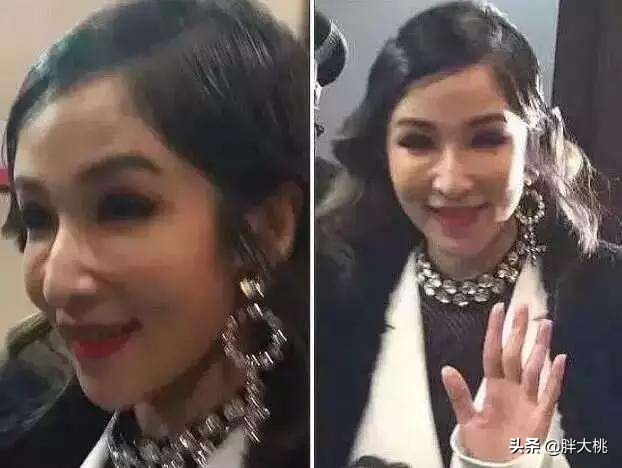 萧亚轩是不是打了玻尿酸一眼便知，明星没有玻尿酸会怎么样？