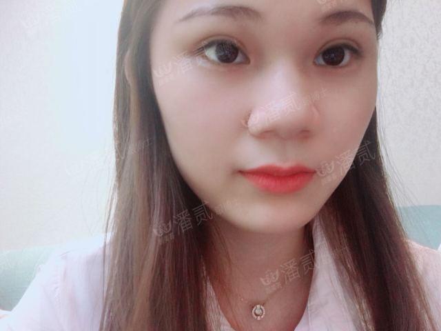 什么样的肿眼泡适合全切,什么样的肿眼泡不用动提肌