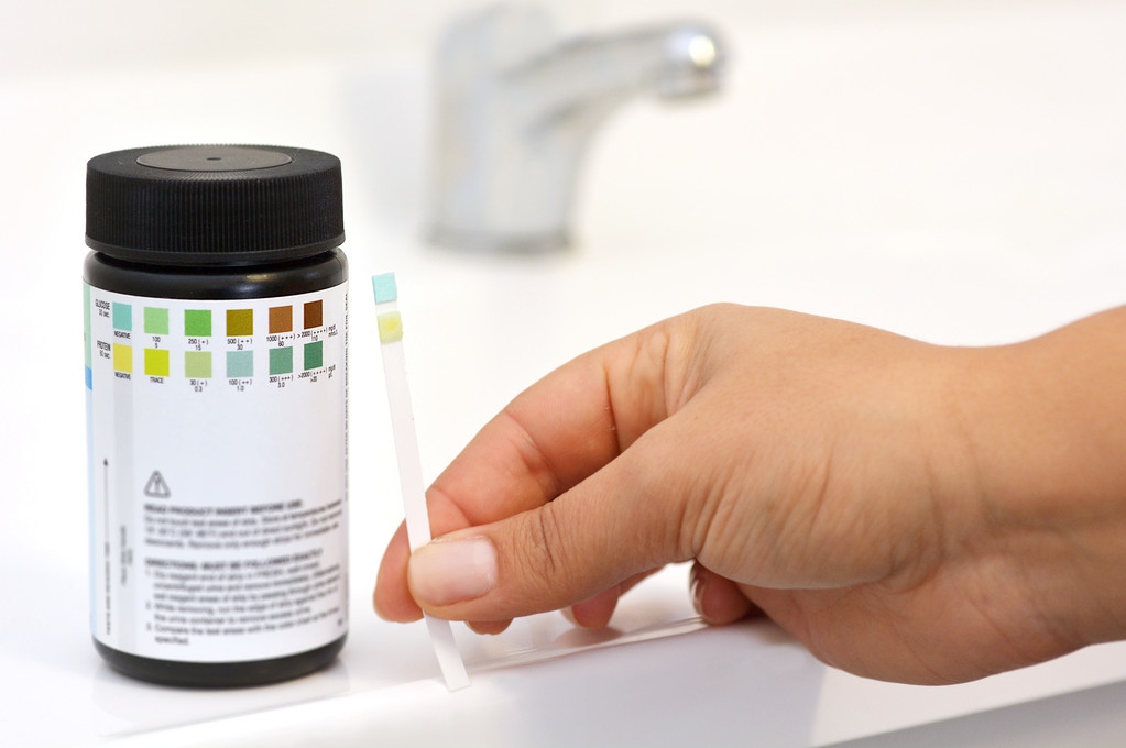 突然发现大量蛋白尿是什么原因,出现蛋白尿怎么查病因