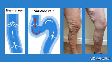 青花釉蚯蚓纹,宣德青花蚯蚓纹