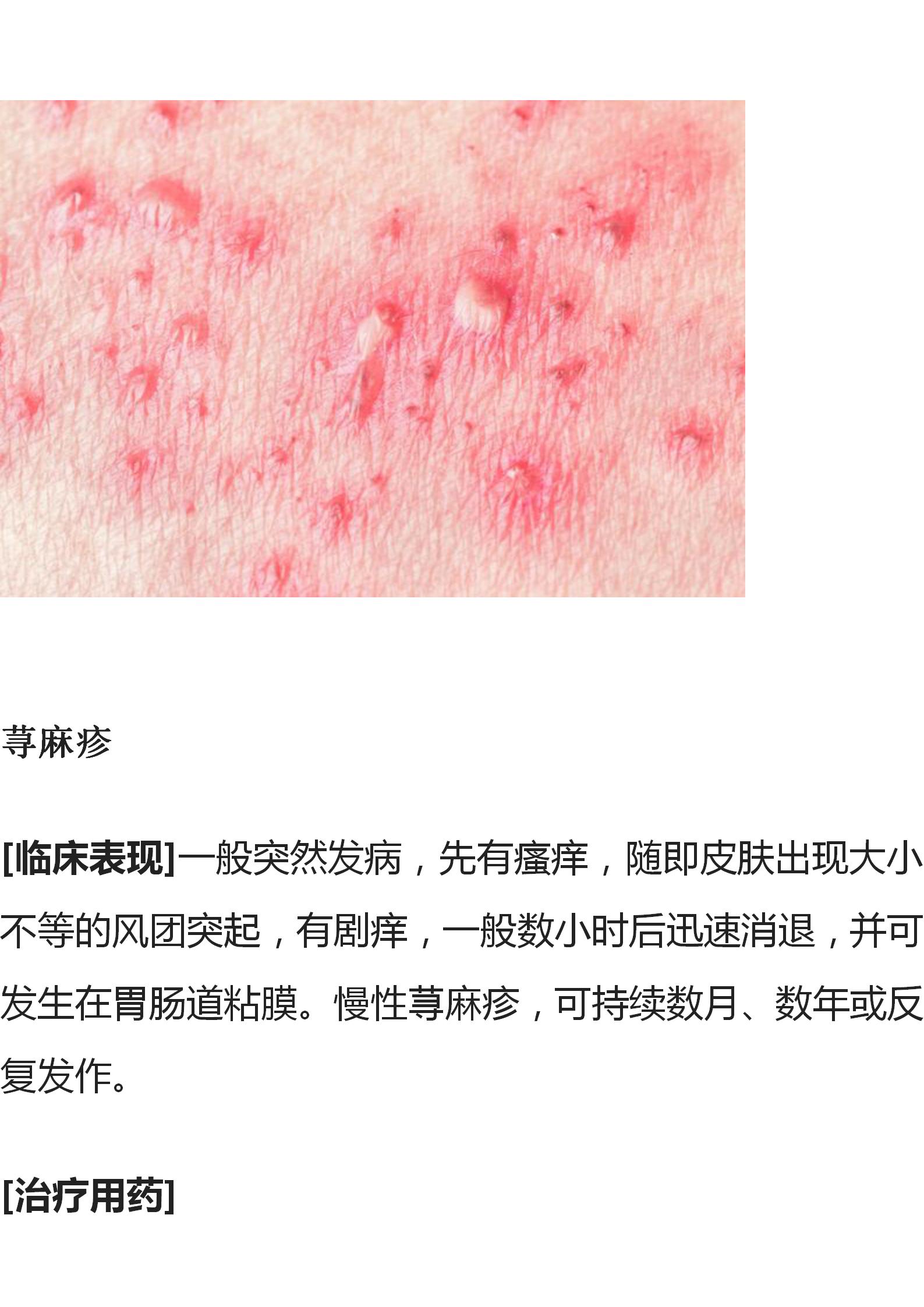 医生总结常见皮肤病用药指南收藏,多种治疗皮肤病的中成药