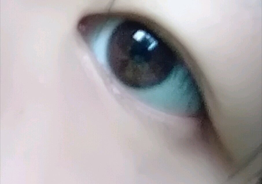 当代人最常见的亚健康表现,造成亚健康的原因有哪几个方面