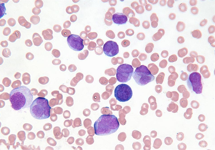 辟谣，猫咪白细胞激增就是患病？主人被告知：压力也会导致其升高