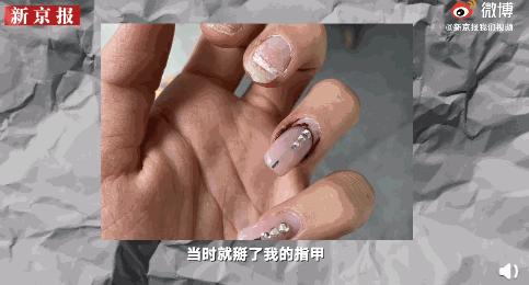 张培萌回应家暴妻子夫妻打架,张培萌妻子谈被家暴