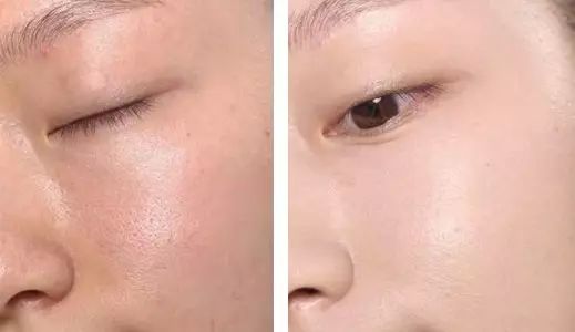 修护肌肤屏障平价面膜推荐,补水焕白修复屏障面膜