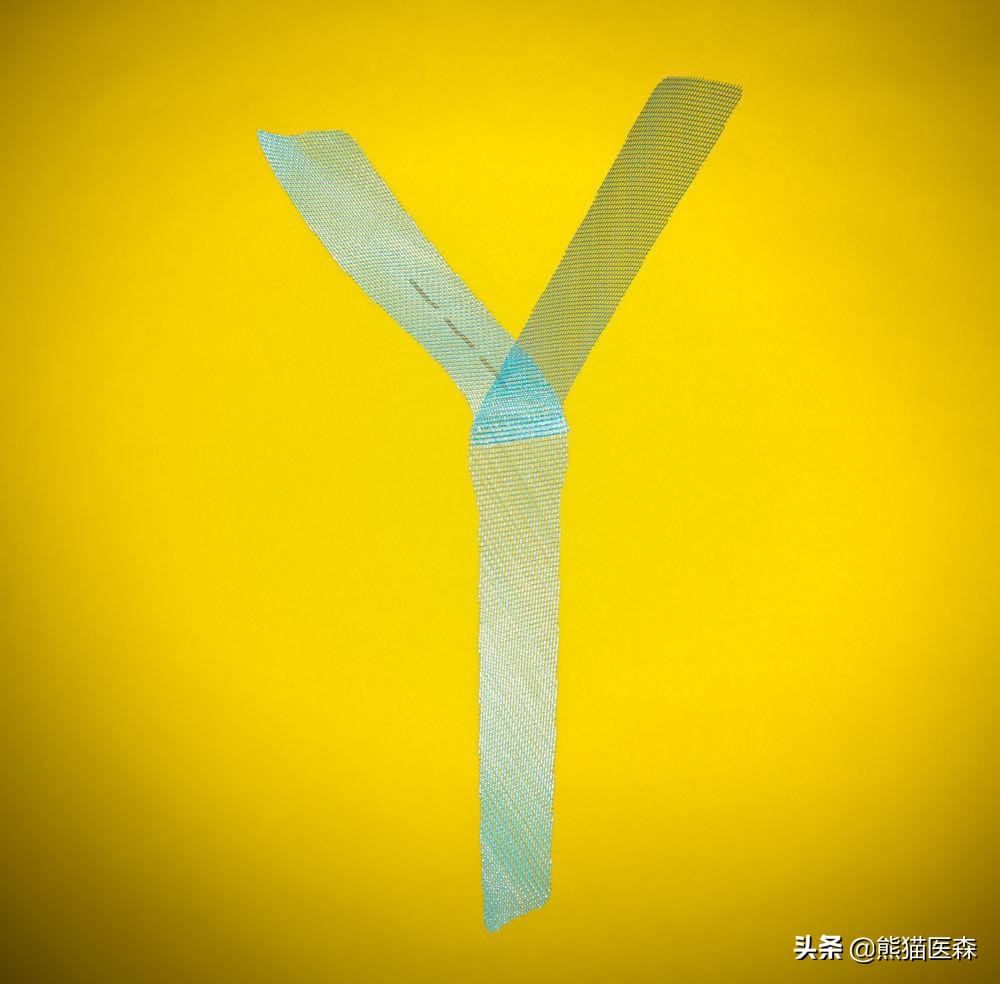 男性吊带手术是小手术吗,吊带手术是什么科做