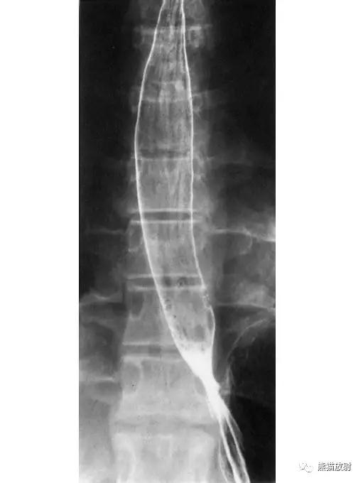 详细的消化道造影+彩色解剖图