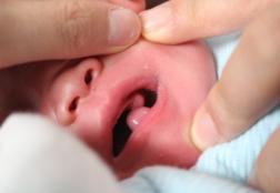 鐗欓緢涓婂皬鑲跨槫,鐗欓緢涓婄殑鑲跨槫