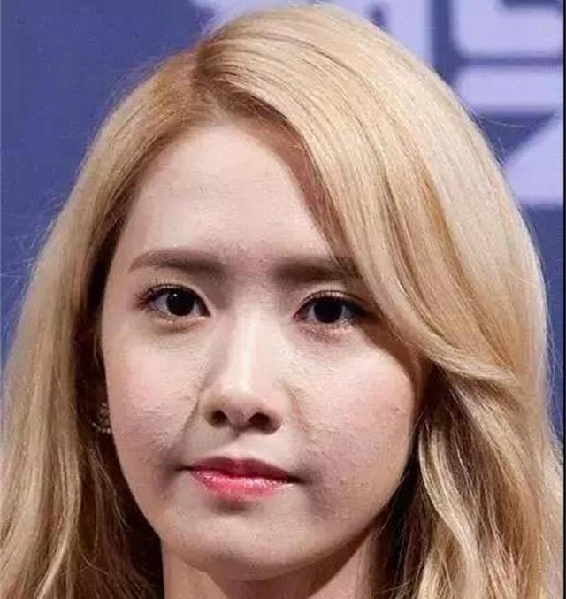 长闭口不挤会慢慢消掉吗,闭口粉刺可以自行消退吗