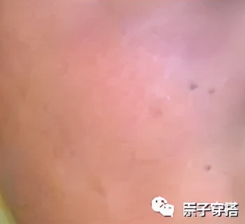 男生脸部护肤的正确步骤,男生护肤需要哪几样