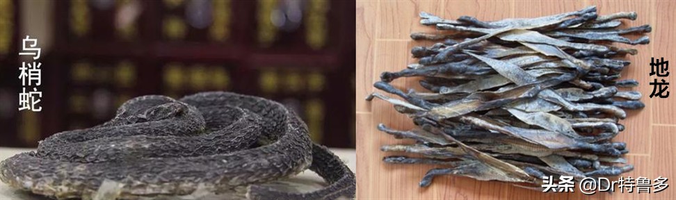 牛皮癣导致关节肿痛如何止痛,得了牛皮癣能治愈吗