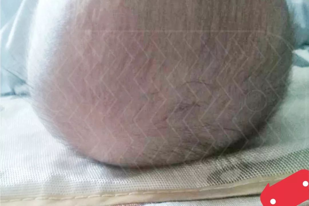 宝宝头睡偏了可以平睡纠正吗,头偏长的宝宝怎么睡头型