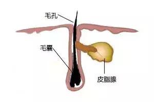 祛鼻头黑头最有效的方法,去黑头的错误做法