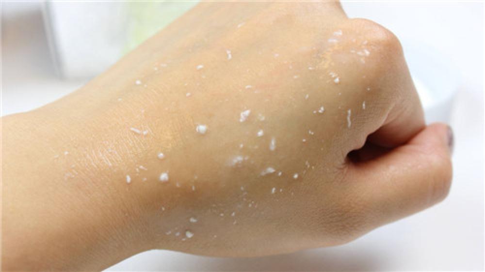 怎样清除脸上的角质,皮肤角质清理指南