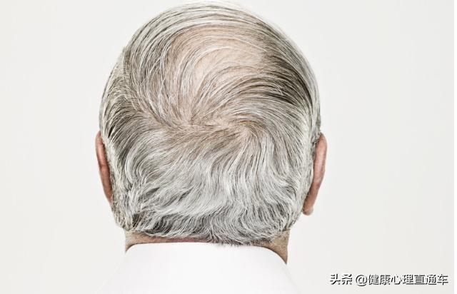 一夜白头可能吗？可能是缺少维生素，教你如何白发变黑发
