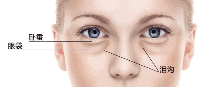 罗志祥的眼袋图片,罗志祥卧蚕眼真实照片