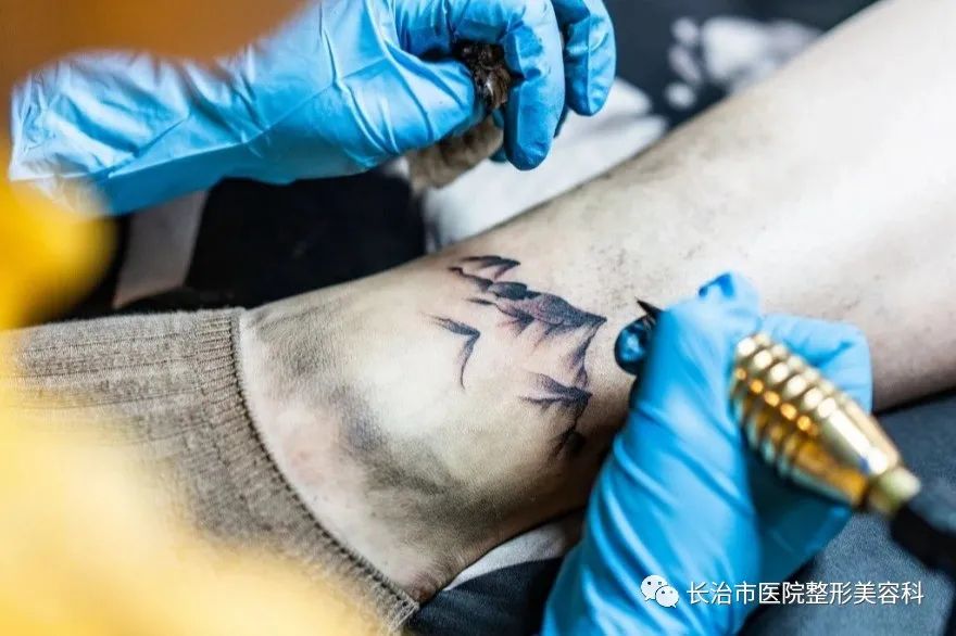 美容激光是什么,激光美容波长表对照表