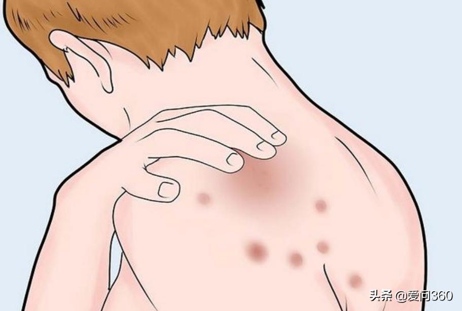 皮肤瘙痒不止，怎么治都不管用，只是用错了方法