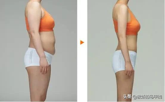 跳绳和跑步哪个会让小腿变粗,运动小腿越来越粗壮