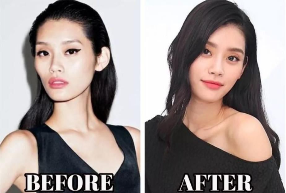 颧骨高太阳穴凹陷卷发,高颧骨太阳穴凹陷卷发