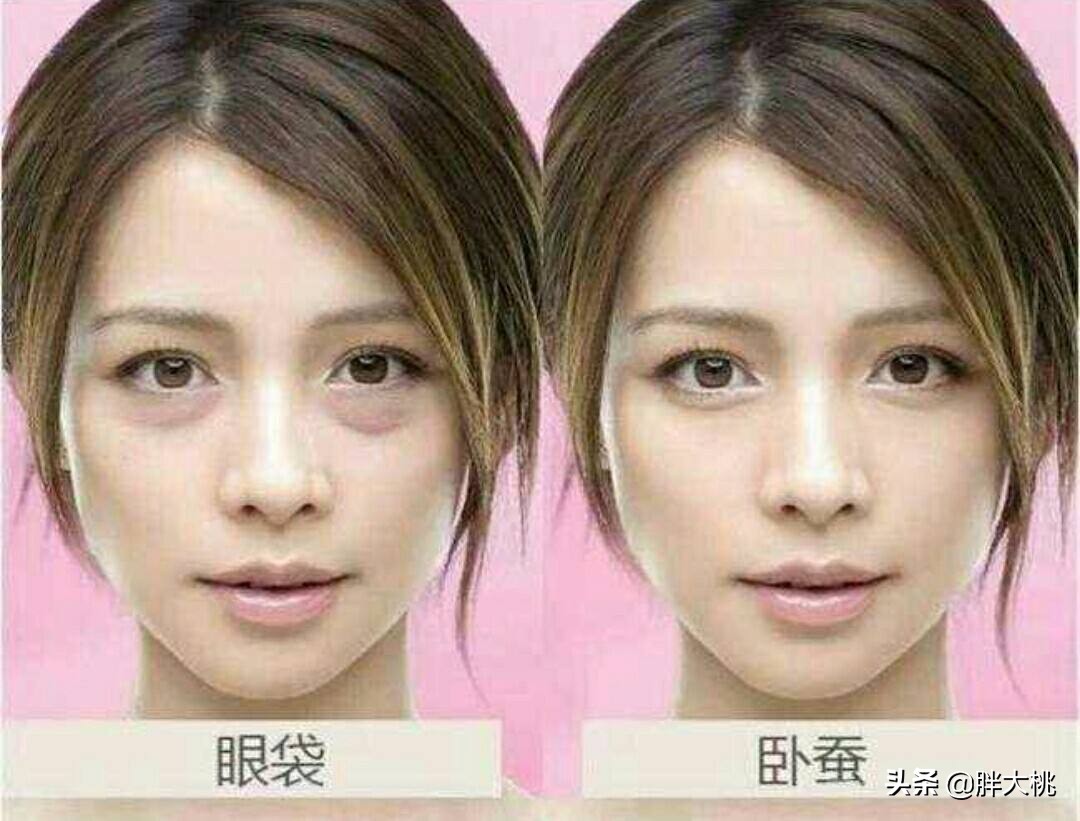 卧蚕和眼袋有啥不一样呢,卧蚕跟眼袋傻傻分不清