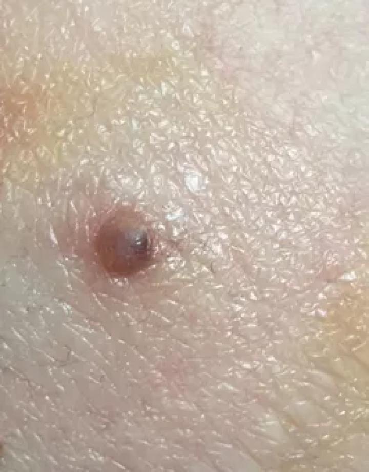 哪些部位长痣预示一生劳碌,痣的位置预示着什么