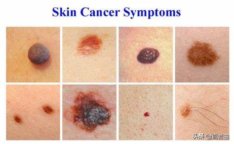 女性自我检查100例,女性自我检查身体最佳时间