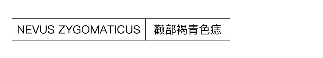 不做黄脸婆教你如何淡化色斑,色斑修复的最佳方法