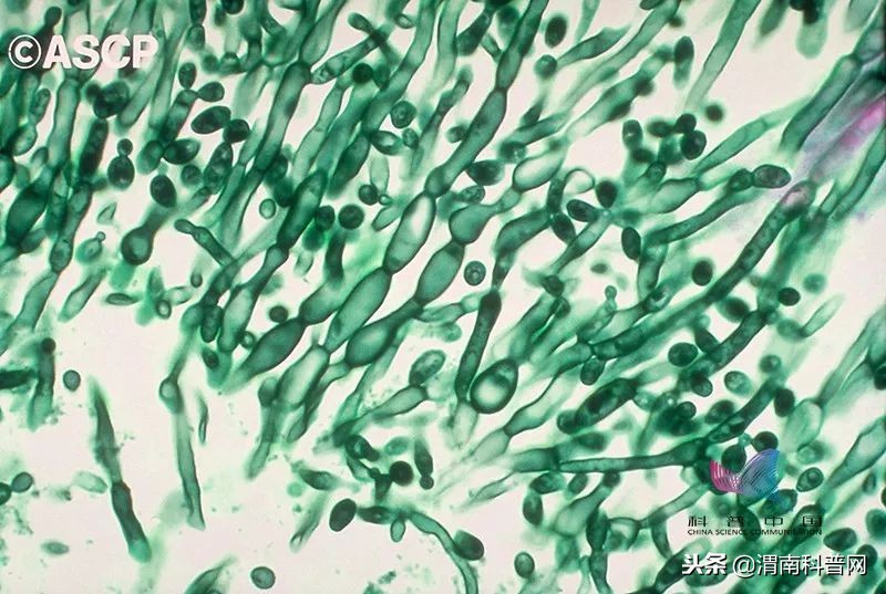 真菌是怎么感染动物的,真菌是怎么感染虫子的