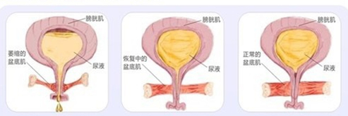 产后谢依霖,谢依霖后遗症有哪些表现