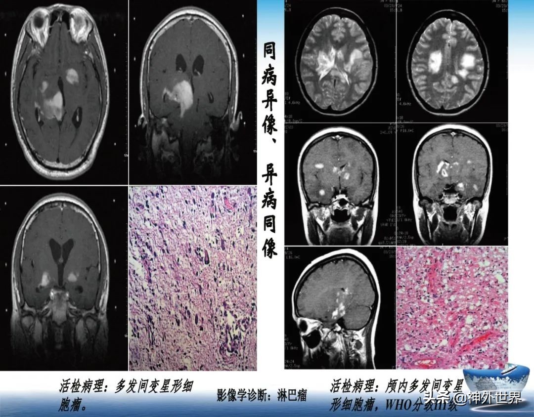宣武医院神经外科王亚明祖籍,北京宣武医院神经科专家王亚明