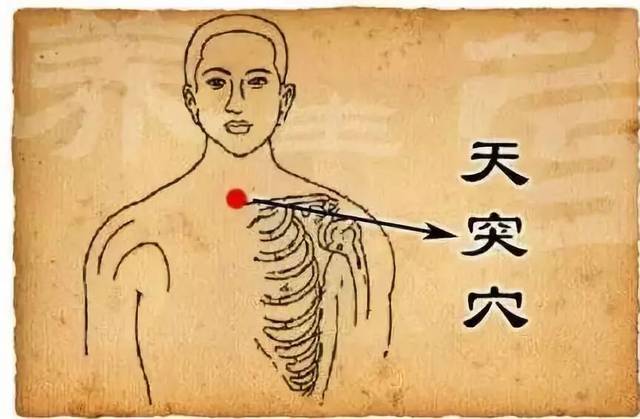 慢性咽炎、喉咙红肿、咽喉肿痛用什么药?
