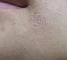 小棕瓶的使用搭配,小棕瓶和什么搭配效果好