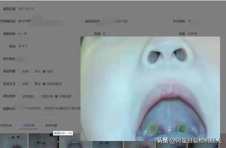 幼儿晨检口腔检查注意事项,阿童目智能晨检机器人晨检功能