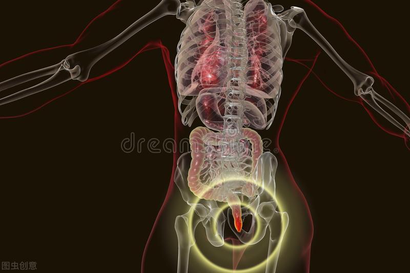 肛门白天不痒晚上很痒是怎么治疗,肛门总是痒痒是怎么回事怎么治疗
