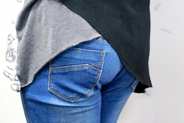 为什么吃中草药治痔疮肛门会痒痒,肛门痒痒什么原因