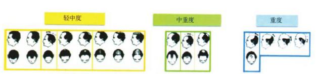 生酮饮食脱发严重怎么办,雄激素性脱发饮食注意什么