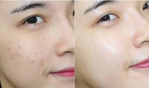 国货肤美灵蓝胖子洗面奶测评,老国货护肤品洗面奶