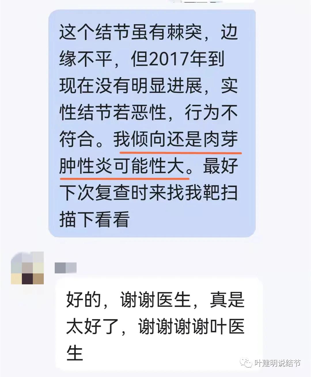 问诊分析：存在了4年的实性结节会不会是肺癌？