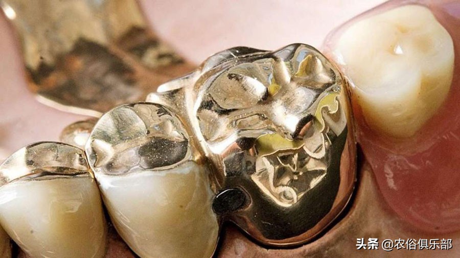 老人去世土葬可以佩戴黄金吗,老人死后可以戴黄金首饰土葬吗