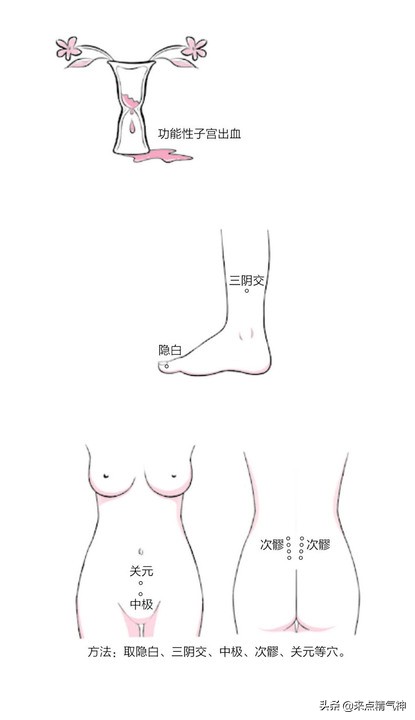 艾灸疏通肝脾肾三经,艾灸治三尖瓣反流