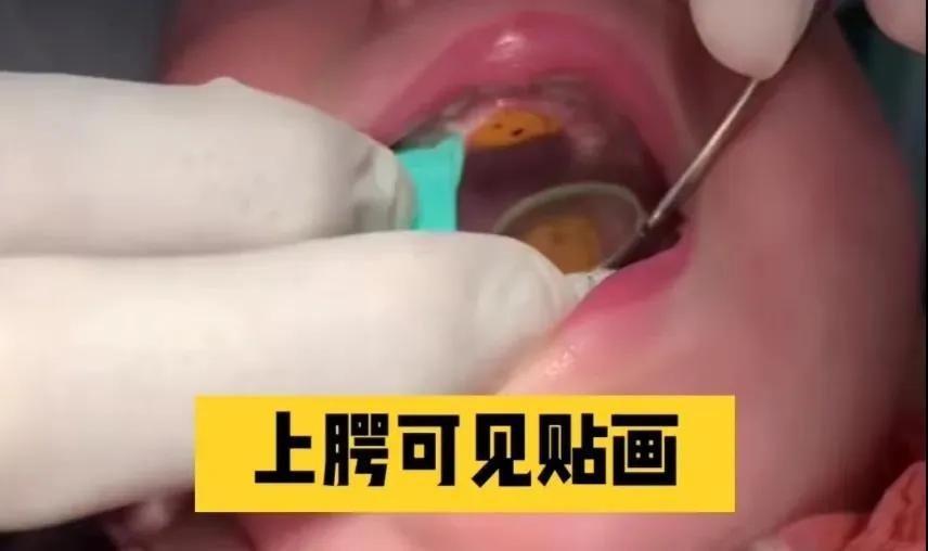 2岁宝宝误食贴画怎么办,8个月大宝宝误食小贴画咳不出来