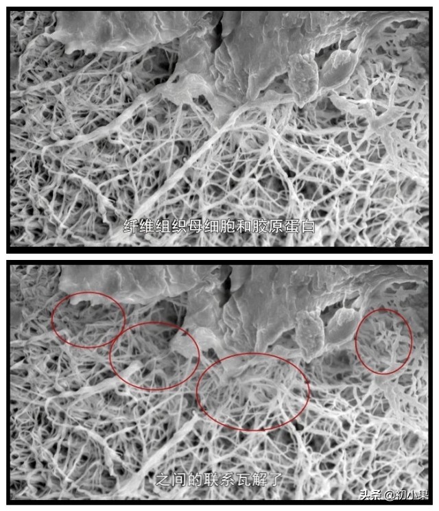 你流失的胶原蛋白补回来了吗,脸部胶原蛋白流失怎么补