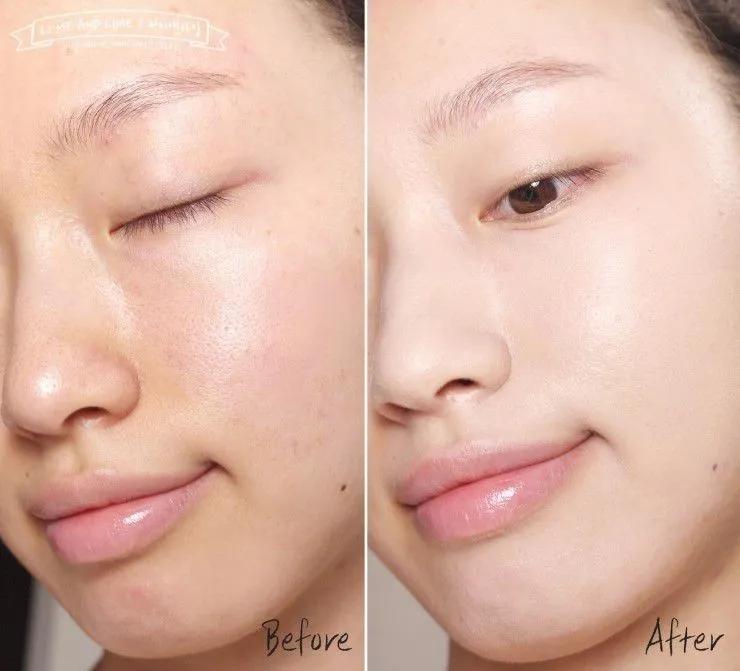 夏季毛孔清爽一夏,夏日毛孔粗大怎么拯救