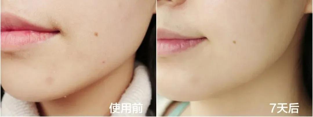 面容憔悴脸颊凹陷,怎么拯救我的老脸