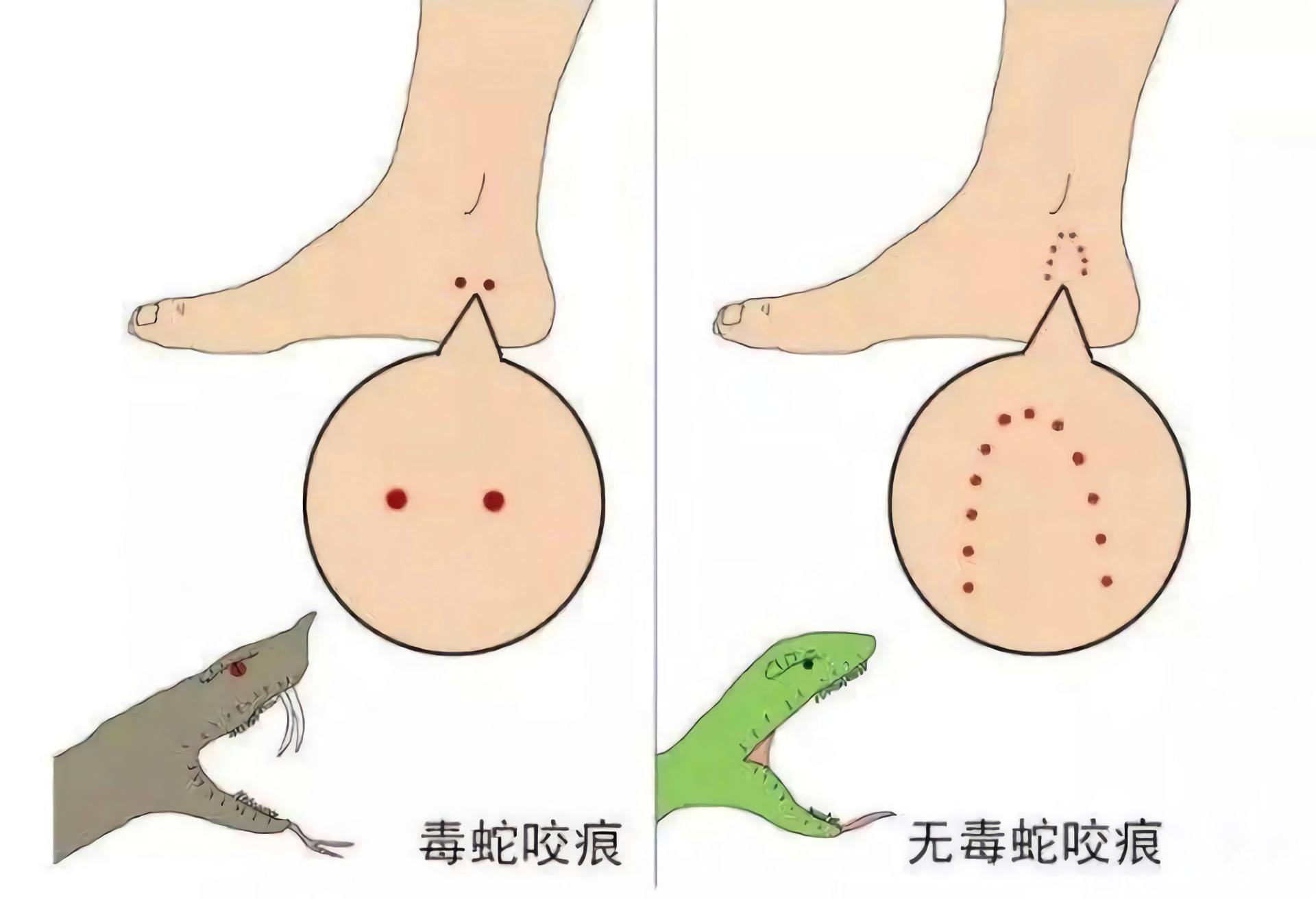 蛇打七寸打哪里最好,为什么打七寸蛇好