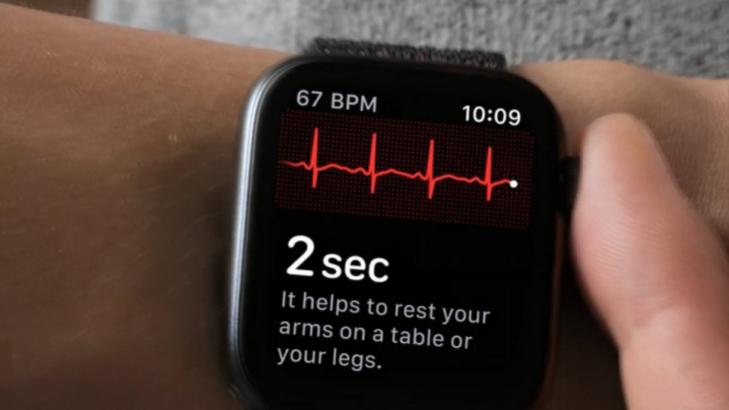 applewatchseries4怎么设置,applewatch4的使用小技巧